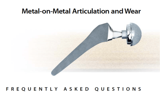 Metal-on-Metal FAQ