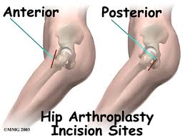 Anterior v Posterior images