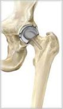 BHR 12 images.jpg BHR 12 images