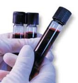 Blood test index.jpg Blood test index