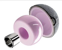 Ceramic on ceramic images