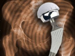 Depuy 3 images.jpg Depuy 3 images