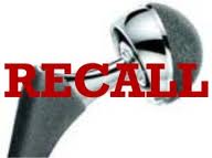 DePuy Hip Recall 4 images