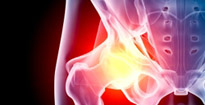 depuy-hip-replacement