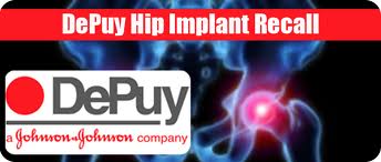 Depuy Recall 2 images