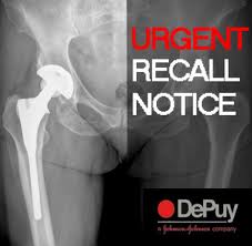 Depuy recall 7 images