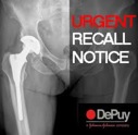 Depuy recall 7 images.jpg Depuy recall 7 images