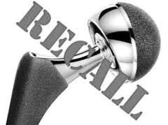 Depuy recall 9 images