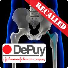 Depuy Recall images