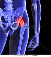 Hip pain 12 images