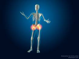 Hip Pain 20 images