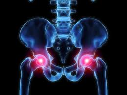Hip Pain images