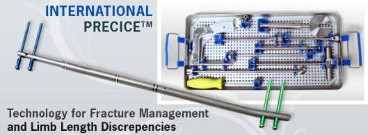 Limb Lengthening procedures 4