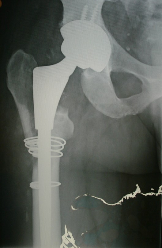X-Rays 30 Sept 2011 020 CR