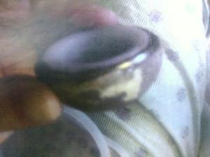 Tim Acetabular cup 2