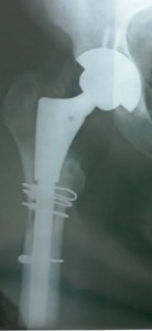 x-rays-post-revision-es-003-cr